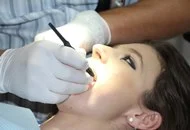Cum se obtine o fixare cat mai stabila a implantului dentar?
