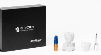Caracteristicile implantului dentar MegaGen AnyRidge