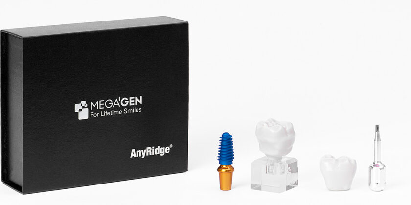 Caracteristicile implantului dentar MegaGen AnyRidge