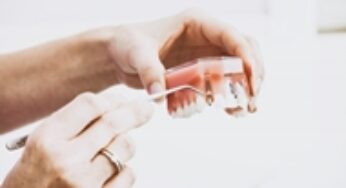 Tot ce trebuie sa stii despre implantul dentar Alpha Bio