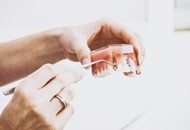 Tot ce trebuie sa stii despre implantul dentar Alpha Bio