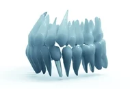 De ce sa optezi pentru un implant dentar Straumann