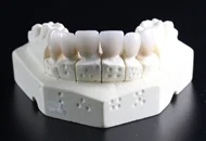 Cati ani rezista un implant dentar?