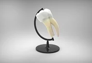 Intrebari frecvente despre implantul dentar