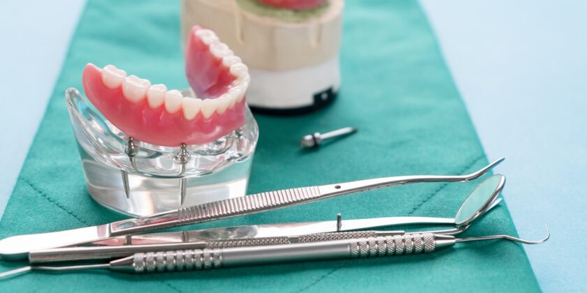 De ce sa optezi pentru un implant dentar din zirconiu?