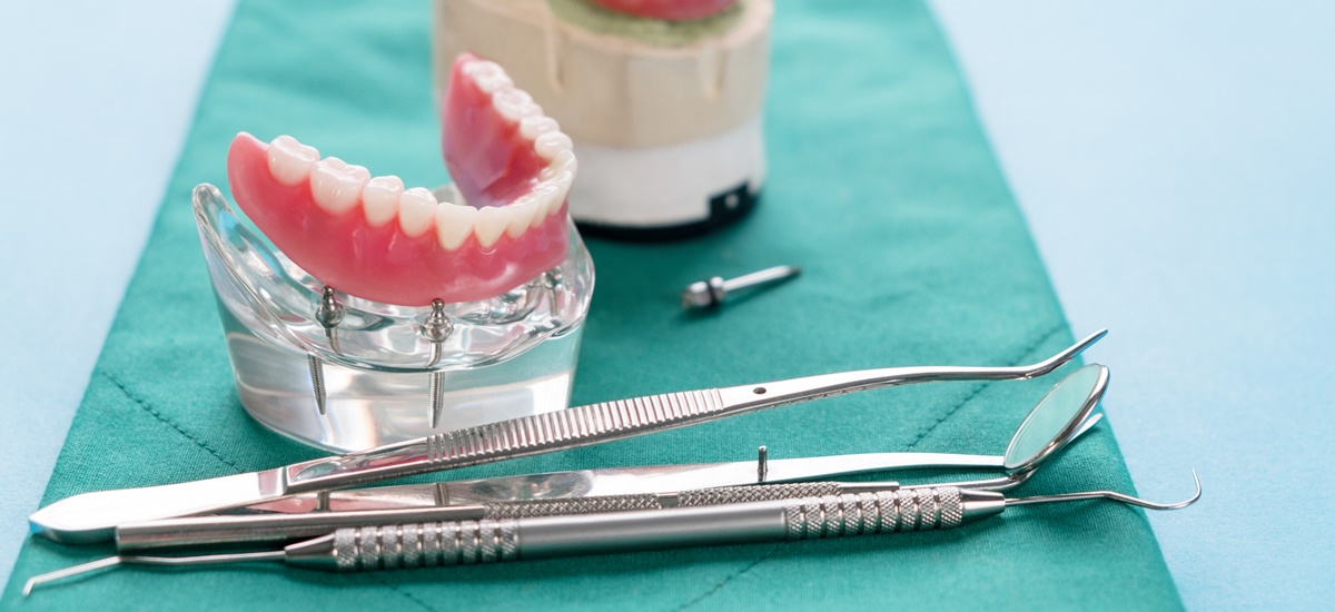 De ce sa optezi pentru un implant dentar din zirconiu?